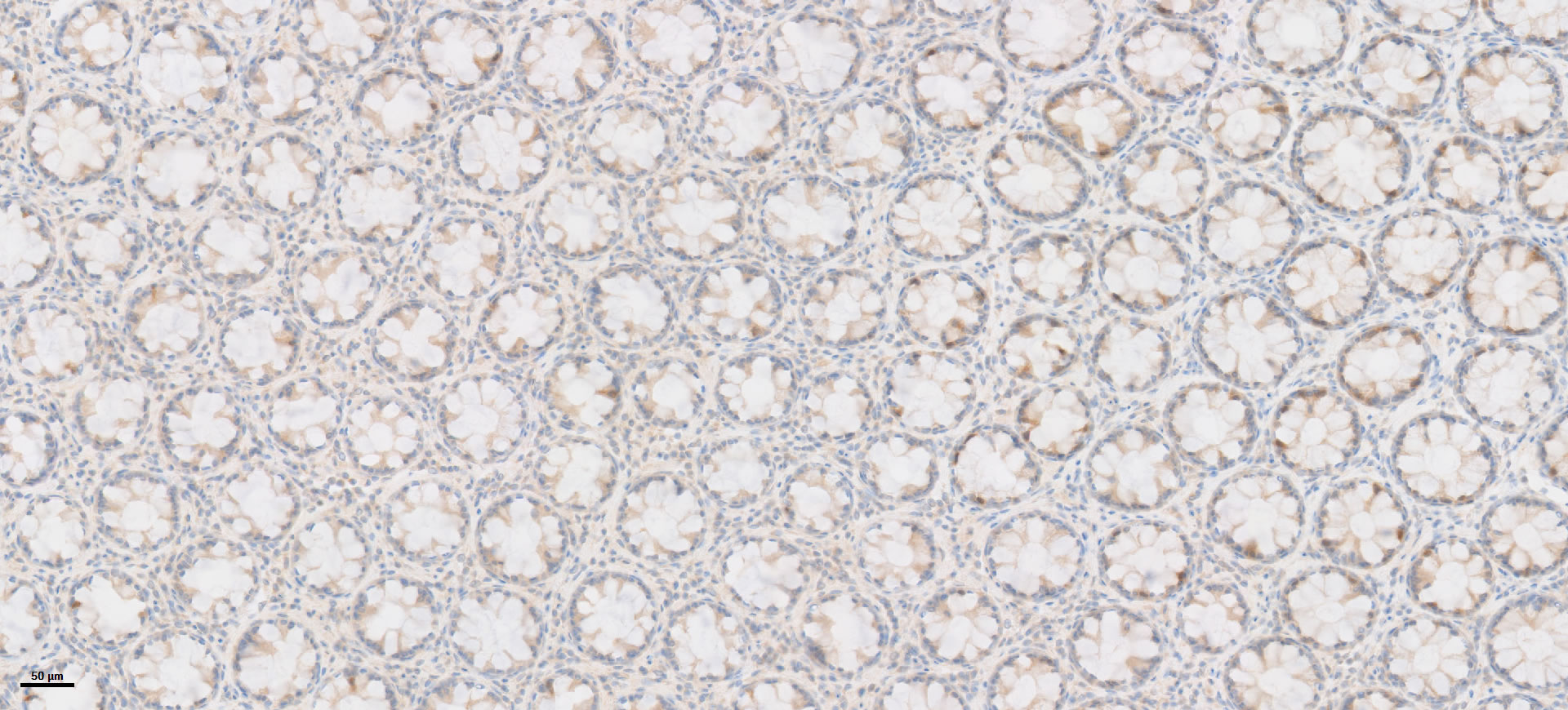 Human intestine 8_13